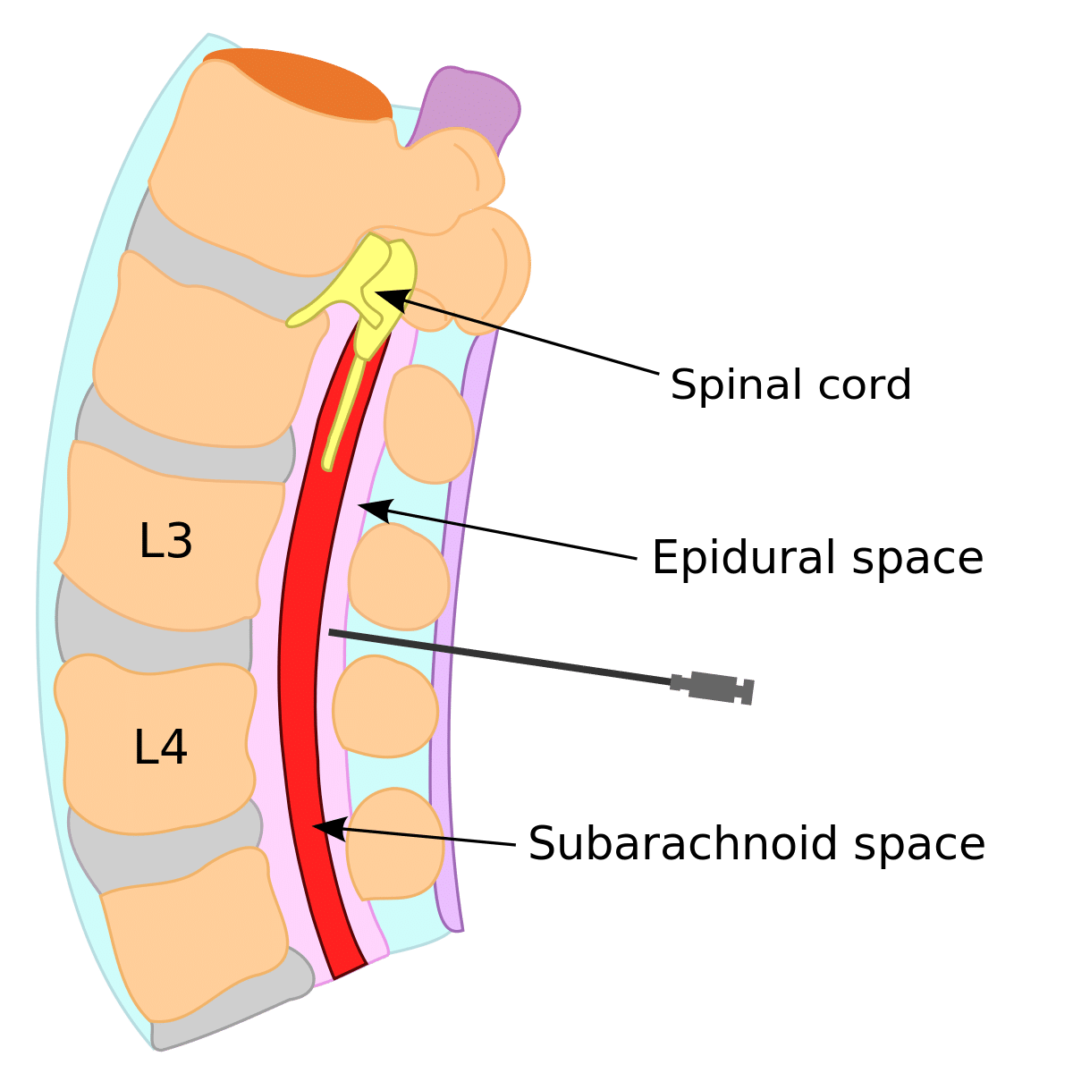 Lumbar Sympathetic Block