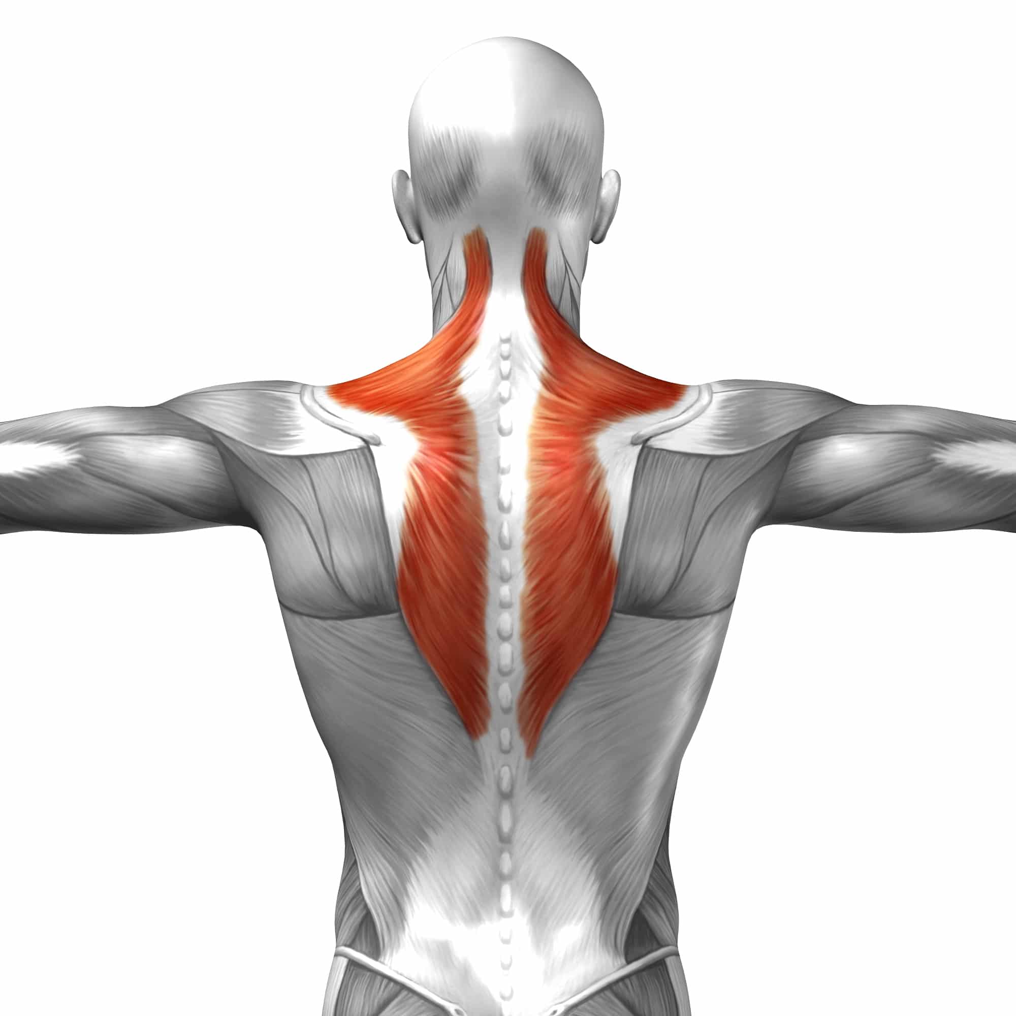 Muscle Strain of the Upper Back