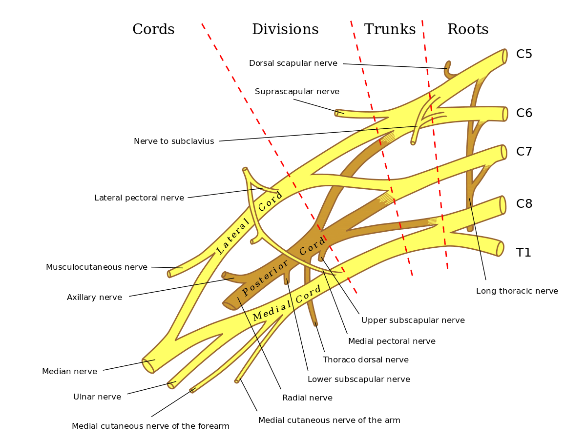 Brachial Plexus Block